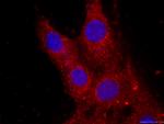 CKM-Specific Antibody in Immunocytochemistry (ICC/IF)