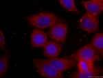 BCL2 Antibody in Immunocytochemistry (ICC/IF)