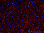 NF-L Antibody in Immunohistochemistry (PFA fixed) (IHC (PFA))