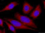 STAT3 Antibody in Immunocytochemistry (ICC/IF)