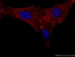 Myosin Light Chain 2 Antibody in Immunocytochemistry (ICC/IF)