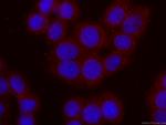 IL1R2 Antibody in Immunocytochemistry (ICC/IF)