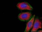 PKM2-specific Antibody in Immunocytochemistry (ICC/IF)