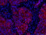 TNF alpha Antibody in Immunohistochemistry (PFA fixed) (IHC (PFA))