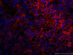 HER2/ErbB2 Antibody in Immunohistochemistry (PFA fixed) (IHC (PFA))