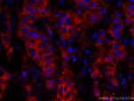 HER2/ErbB2 Antibody in Immunohistochemistry (PFA fixed) (IHC (PFA))