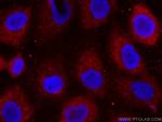 Cytokeratin 14 Antibody in Immunocytochemistry (ICC/IF)