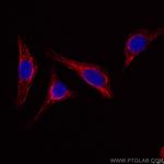 Vimentin Antibody in Immunocytochemistry (ICC/IF)