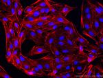 beta Actin Antibody in Immunocytochemistry (ICC/IF)