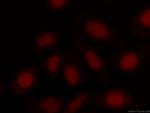 Transketolase Antibody in Immunocytochemistry (ICC/IF)