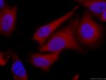 TPPII Antibody in Immunocytochemistry (ICC/IF)