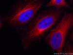 alpha Tubulin Antibody in Immunocytochemistry (ICC/IF)