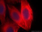 alpha Tubulin Antibody in Immunocytochemistry (ICC/IF)