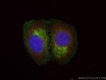 ASS1 Antibody in Immunocytochemistry (ICC/IF)