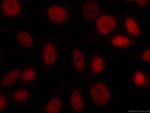 CUL4A Antibody in Immunocytochemistry (ICC/IF)