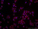 RPS3 Antibody in Immunocytochemistry (ICC/IF)