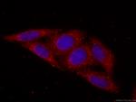 RPS3 Antibody in Immunocytochemistry (ICC/IF)