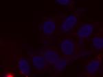 Albumin Antibody in Immunocytochemistry (ICC/IF)