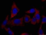 TELO2 Antibody in Immunocytochemistry (ICC/IF)