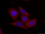 Fetuin-A Antibody in Immunocytochemistry (ICC/IF)