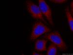 Alpha galactosidase A Antibody in Immunocytochemistry (ICC/IF)