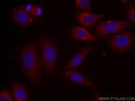 Alpha-2-macroglobulin Antibody in Immunocytochemistry (ICC/IF)