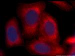 ARG1 Antibody in Immunocytochemistry (ICC/IF)