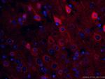 NSE Antibody in Immunohistochemistry (PFA fixed) (IHC (PFA))