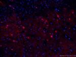 NSE Antibody in Immunohistochemistry (PFA fixed) (IHC (PFA))