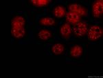 PSMD4 Antibody in Immunocytochemistry (ICC/IF)