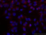 P62/SQSTM1 Antibody in Immunocytochemistry (ICC/IF)