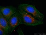 P62/SQSTM1 Antibody in Immunocytochemistry (ICC/IF)