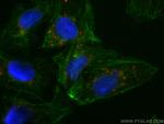 P62/SQSTM1 Antibody in Immunocytochemistry (ICC/IF)