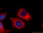 Cytokeratin 18 Antibody in Immunocytochemistry (ICC/IF)