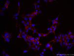 SERPINE2 Antibody in Immunocytochemistry (ICC/IF)