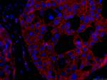 p120 Catenin Antibody in Immunohistochemistry (PFA fixed) (IHC (PFA))