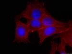 p120 Catenin Antibody in Immunocytochemistry (ICC/IF)