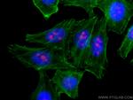 IMP3 Antibody in Immunocytochemistry (ICC/IF)