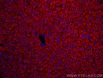 Mcp1 Antibody in Immunohistochemistry (PFA fixed) (IHC (PFA))