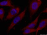 CDK6 Antibody in Immunocytochemistry (ICC/IF)