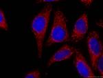 OGDH Antibody in Immunocytochemistry (ICC/IF)