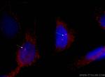 gamma tubulin Antibody in Immunocytochemistry (ICC/IF)