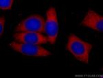 G6PD Antibody in Immunocytochemistry (ICC/IF)