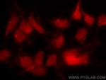 TINP1 Antibody in Immunocytochemistry (ICC/IF)