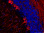 TUBB3-specific Antibody in Immunohistochemistry (PFA fixed) (IHC (PFA))