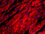 Cardiac Troponin I Antibody in Immunohistochemistry (PFA fixed) (IHC (PFA))