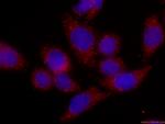 Cardiac Troponin I Antibody in Immunocytochemistry (ICC/IF)