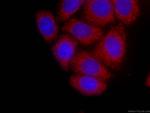 GSDMD Antibody in Immunocytochemistry (ICC/IF)