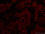 GATA3 Antibody in Immunohistochemistry (PFA fixed) (IHC (PFA))