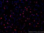 SOX2 Antibody in Immunohistochemistry (PFA fixed) (IHC (PFA))